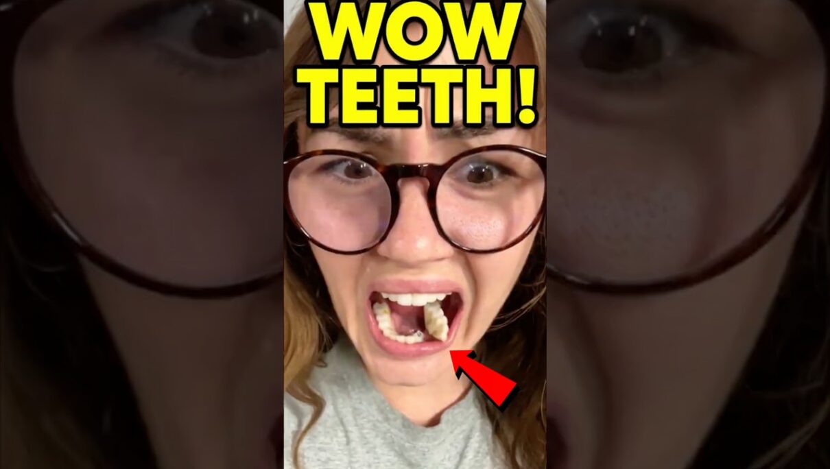 What The Dentist Did Shocked Everyone 😳